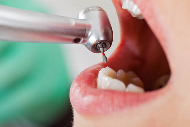 Best Cosmetic Emergency Dentistry in Hardinsburg, KY